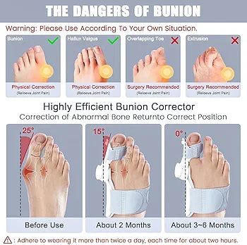 Bunion correcter